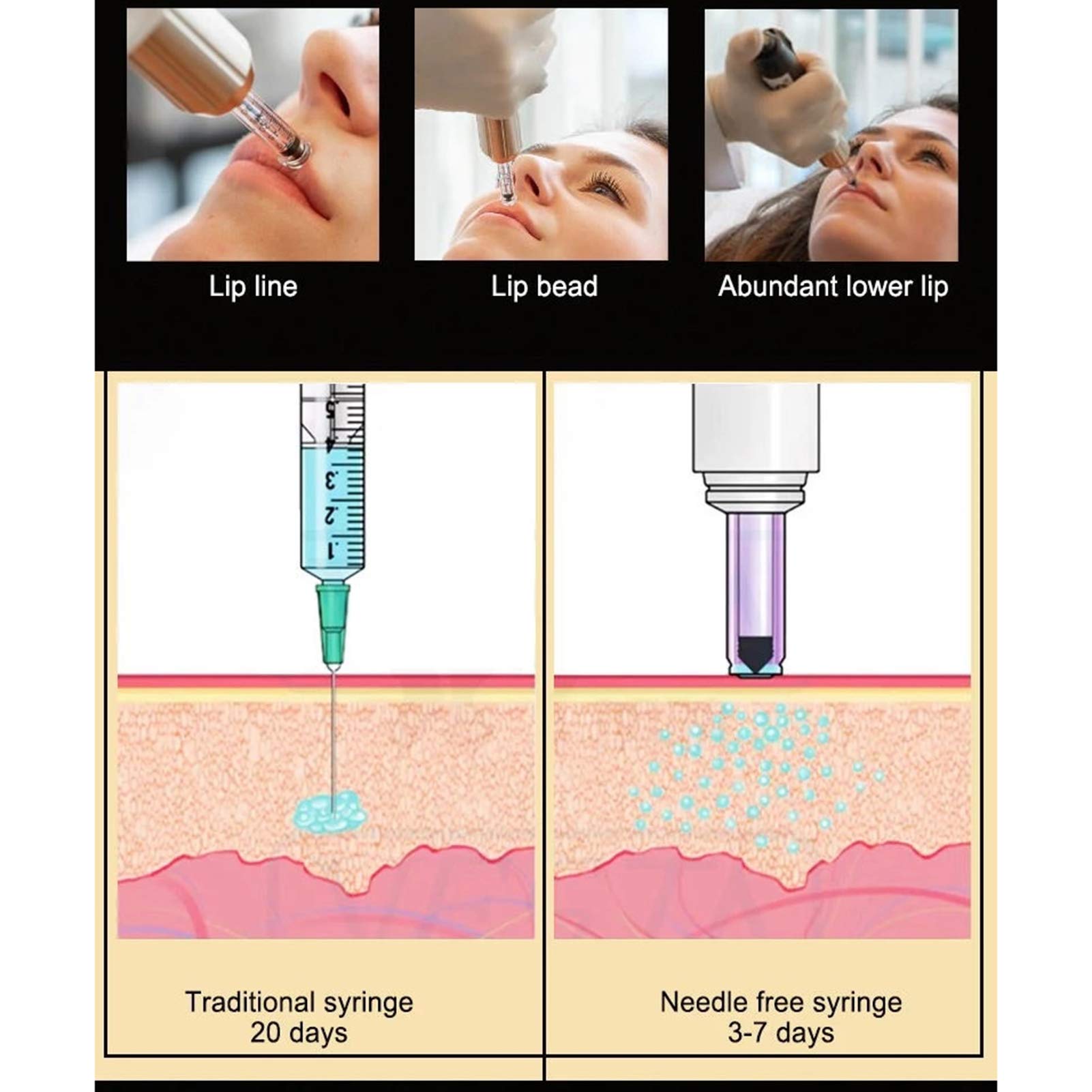Amazon.co.jp: ヒアルロン酸マイクロインジェクターペン、非侵襲的非針